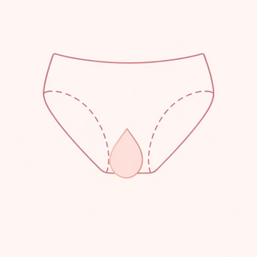 小陰唇のはみ出し
